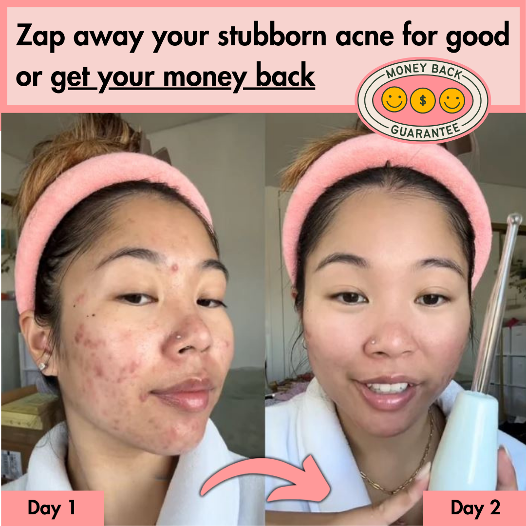 NeuroGlow™ - High Frequency Wand